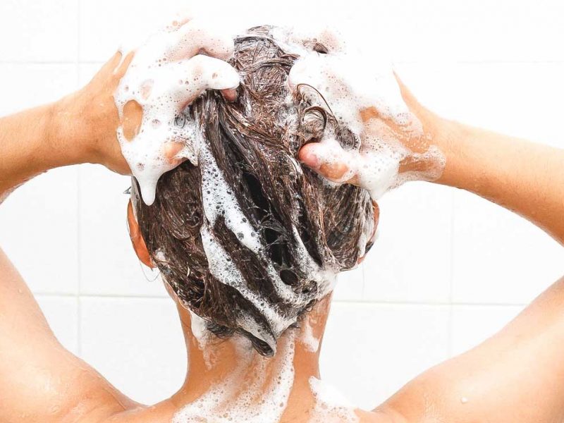 How To Shop For The Best Oily Scalp Shampoo For Dandruff Issues?